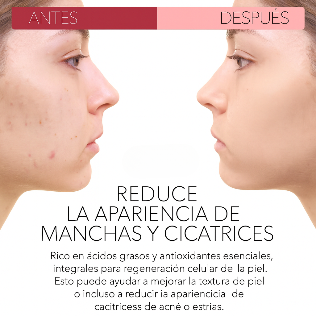 Aceite Rosa Mosqueta